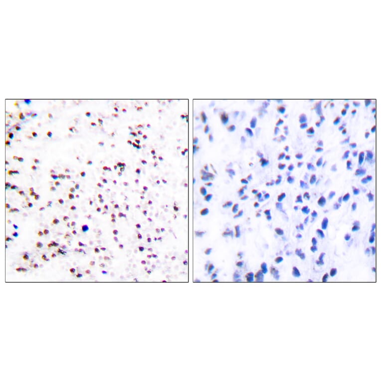 Immunohistochemistry - Anti-MCM5 Antibody (C0260) - Antibodies.com