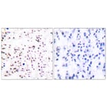 Immunohistochemistry - Anti-MCM5 Antibody (C0260) - Antibodies.com