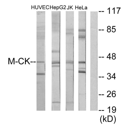 Western Blot - Anti-M-CK Antibody (C10289) - Antibodies.com