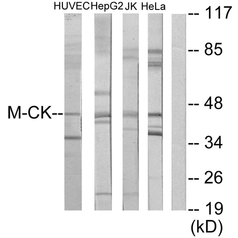 Western Blot - Anti-M-CK Antibody (C10289) - Antibodies.com