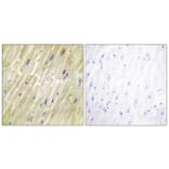 Immunohistochemistry - Anti-M-CK Antibody (C10289) - Antibodies.com