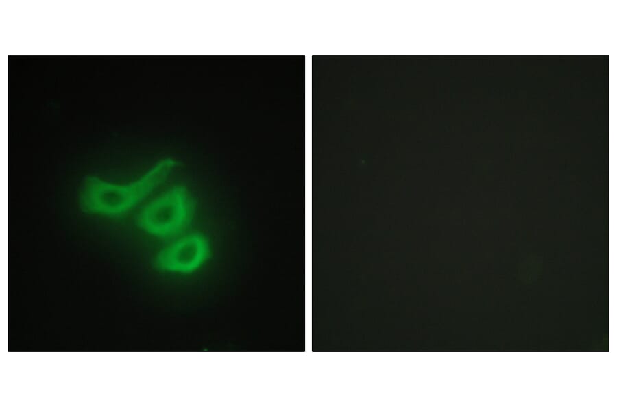 Immunofluorescence - Anti-M-CK Antibody (C10289) - Antibodies.com