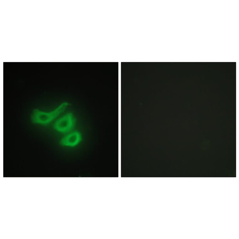 Immunofluorescence - Anti-M-CK Antibody (C10289) - Antibodies.com