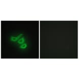 Immunofluorescence - Anti-M-CK Antibody (C10289) - Antibodies.com