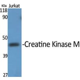 Western Blot - Anti-M-CK Antibody (C10289) - Antibodies.com