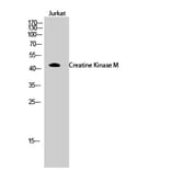 Western Blot - Anti-M-CK Antibody (C10289) - Antibodies.com