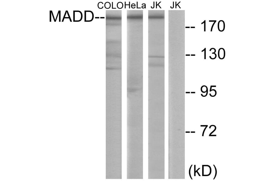 Western Blot - Anti-MADD Antibody (C11414) - Antibodies.com