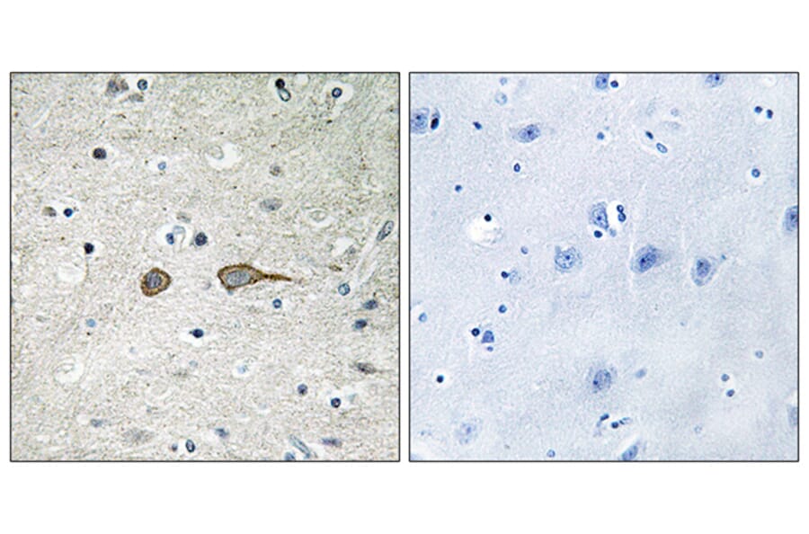Immunohistochemistry - Anti-MADD Antibody (C11414) - Antibodies.com