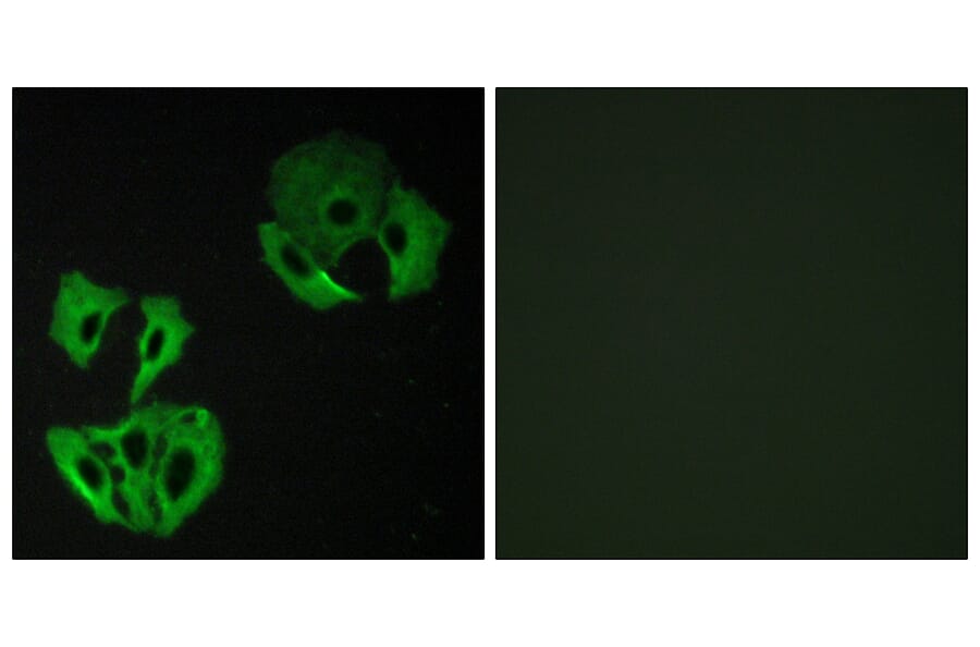 Immunofluorescence - Anti-MADD Antibody (C11414) - Antibodies.com