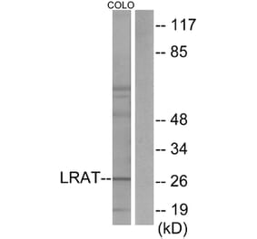 Western Blot - Anti-LRAT Antibody (C10219) - Antibodies.com