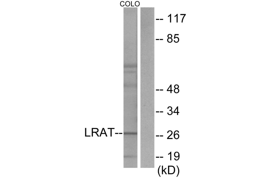 Western Blot - Anti-LRAT Antibody (C10219) - Antibodies.com