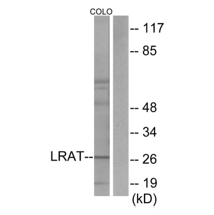 Western Blot - Anti-LRAT Antibody (C10219) - Antibodies.com