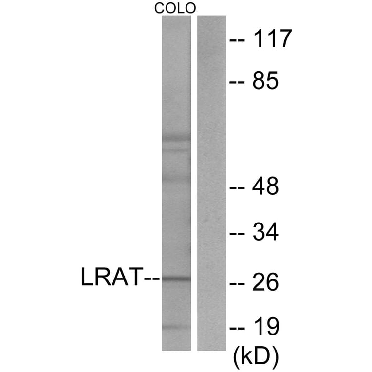 Western Blot - Anti-LRAT Antibody (C10219) - Antibodies.com