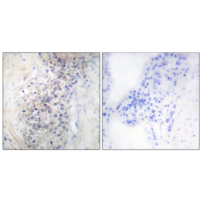 Immunohistochemistry - Anti-LRAT Antibody (C10219) - Antibodies.com