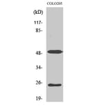 Western Blot - Anti-LRAT Antibody (C10219) - Antibodies.com