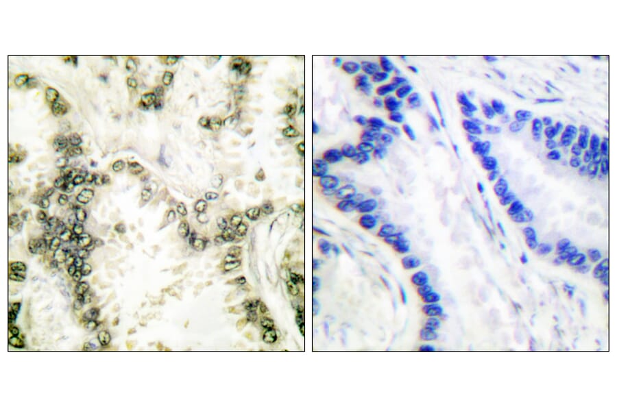 Immunohistochemistry - Anti-Ku70 Antibody (C0253) - Antibodies.com