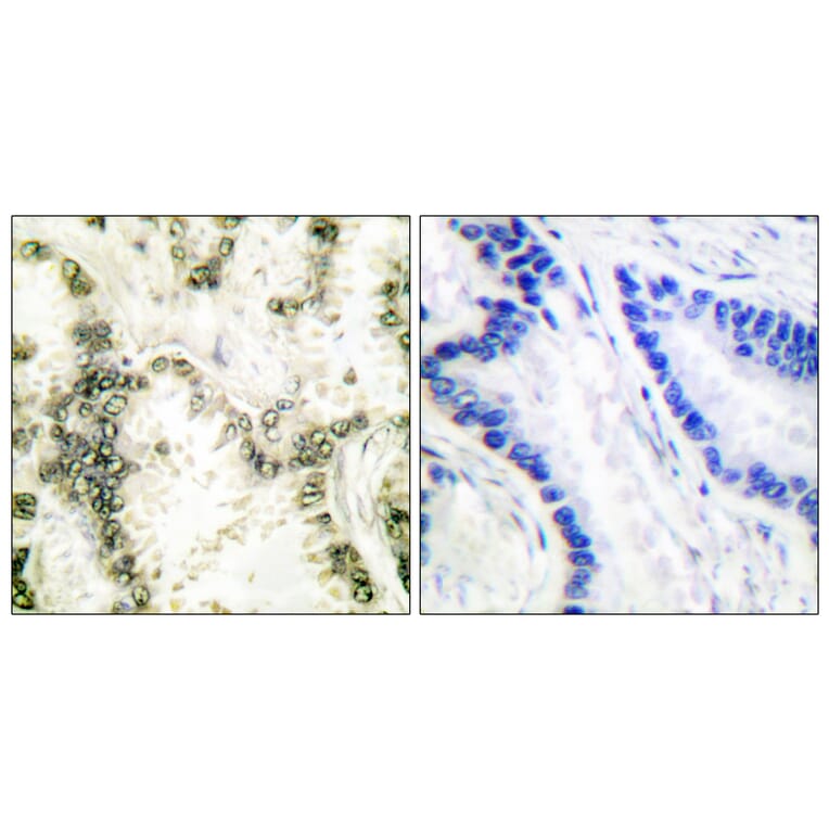 Immunohistochemistry - Anti-Ku70 Antibody (C0253) - Antibodies.com
