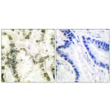 Immunohistochemistry - Anti-Ku70 Antibody (C0253) - Antibodies.com