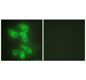 Immunofluorescence - Anti-JIP2 Antibody (C10973) - Antibodies.com