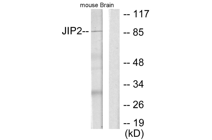 Western Blot - Anti-JIP2 Antibody (C10973) - Antibodies.com