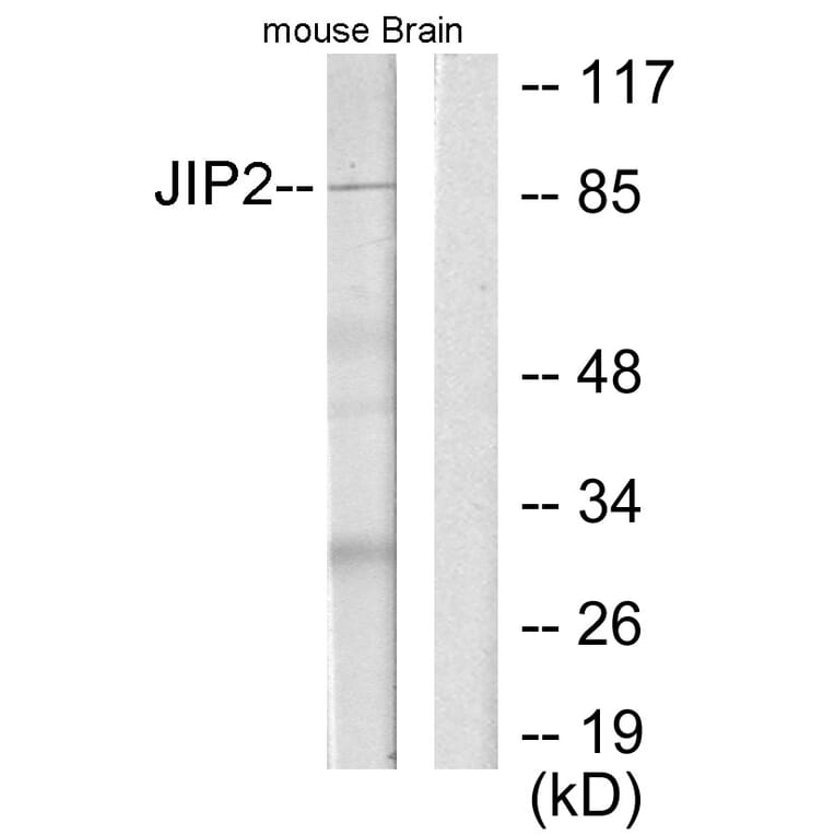 Western Blot - Anti-JIP2 Antibody (C10973) - Antibodies.com