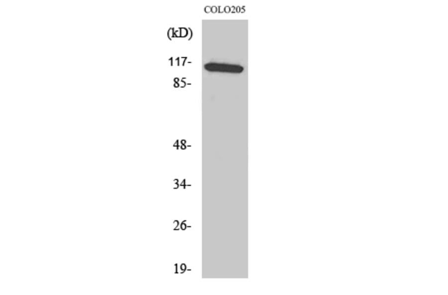 Western Blot - Anti-JIP1 Antibody (B0954) - Antibodies.com