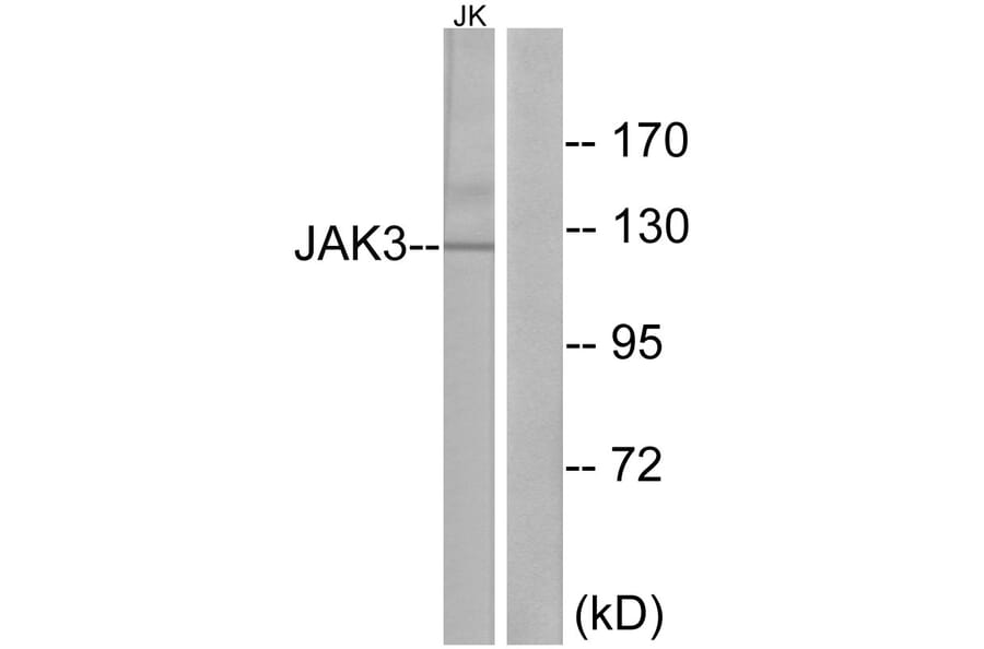 Western Blot - Anti-JAK3 Antibody (B1080) - Antibodies.com