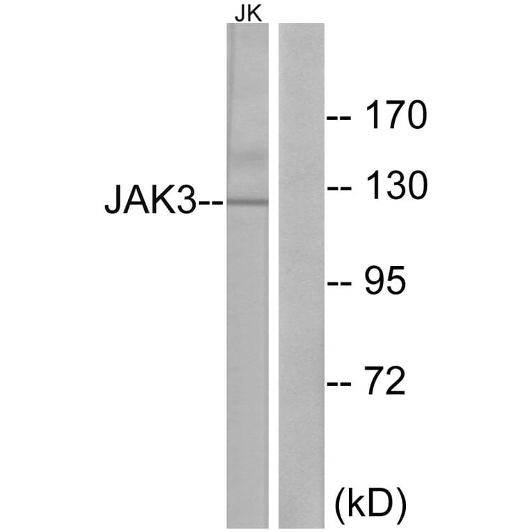 Western Blot - Anti-JAK3 Antibody (B1080) - Antibodies.com