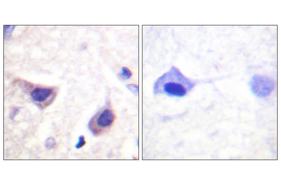 Immunohistochemistry - Anti-JAK3 Antibody (B1080) - Antibodies.com