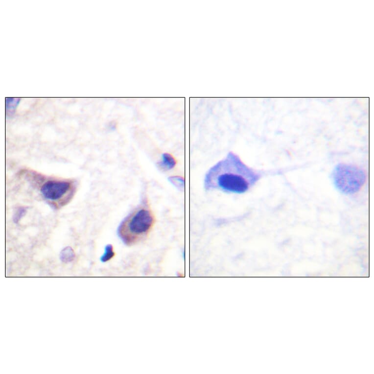 Immunohistochemistry - Anti-JAK3 Antibody (B1080) - Antibodies.com