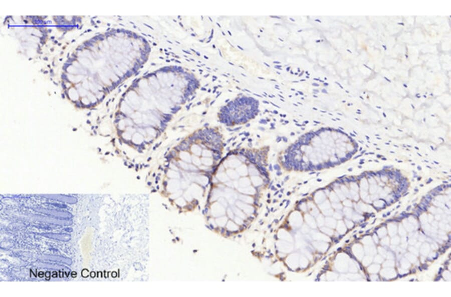 Immunohistochemistry - Anti-JAK3 Antibody (B1080) - Antibodies.com