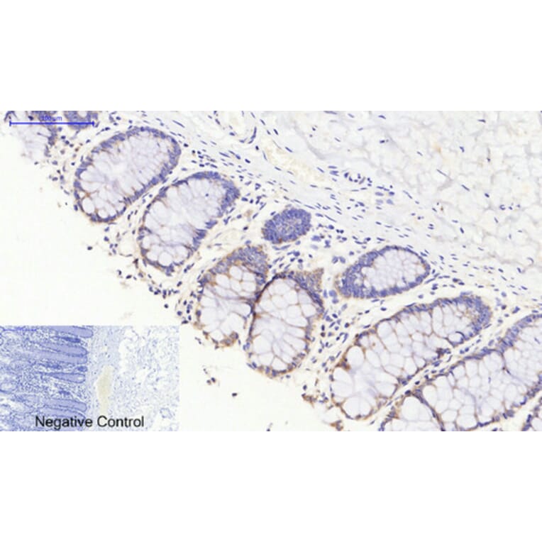 Immunohistochemistry - Anti-JAK3 Antibody (B1080) - Antibodies.com