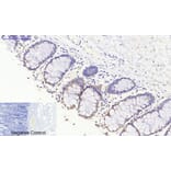 Immunohistochemistry - Anti-JAK3 Antibody (B1080) - Antibodies.com