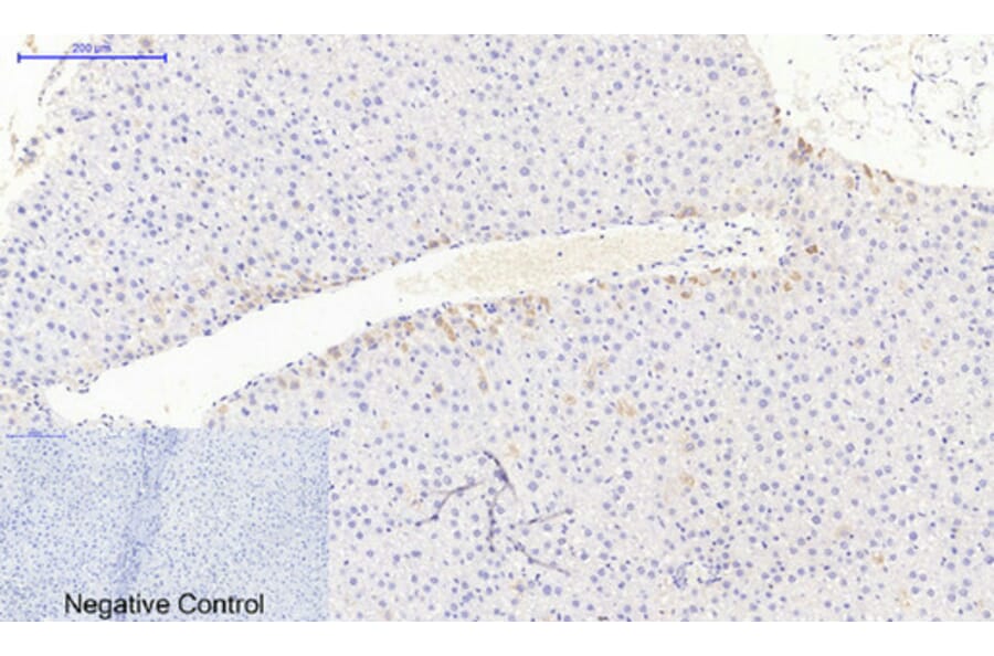 Immunohistochemistry - Anti-JAK3 Antibody (B1080) - Antibodies.com