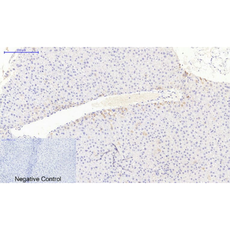 Immunohistochemistry - Anti-JAK3 Antibody (B1080) - Antibodies.com