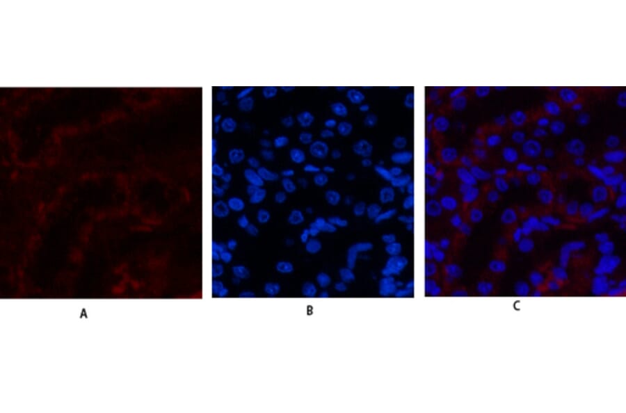 Immunofluorescence - Anti-JAK3 Antibody (B1080) - Antibodies.com
