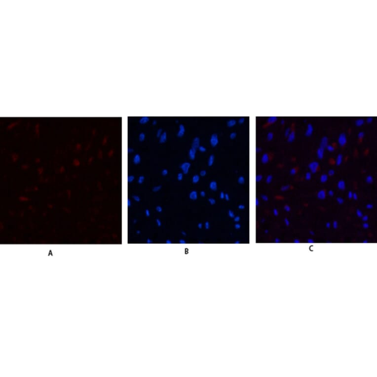 Immunofluorescence - Anti-JAK3 Antibody (B1080) - Antibodies.com
