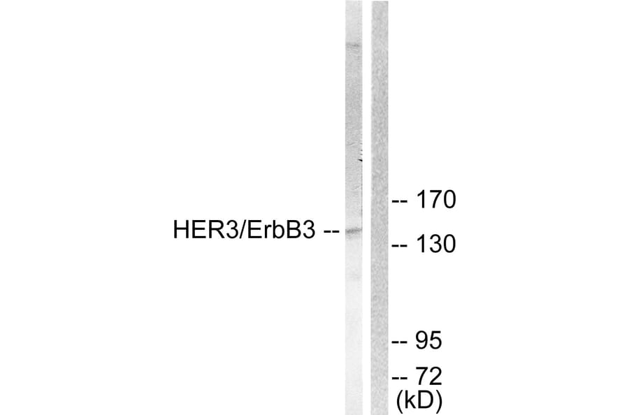 Western Blot - Anti-HER3 Antibody (B0945) - Antibodies.com