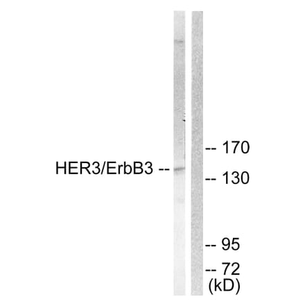 Western Blot - Anti-HER3 Antibody (B0945) - Antibodies.com