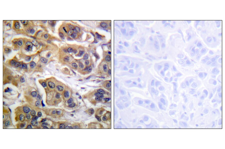 Immunohistochemistry - Anti-HER3 Antibody (B0945) - Antibodies.com