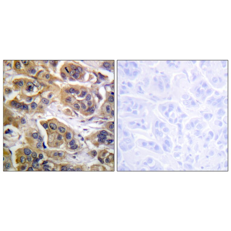 Immunohistochemistry - Anti-HER3 Antibody (B0945) - Antibodies.com