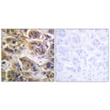 Immunohistochemistry - Anti-HER3 Antibody (B0945) - Antibodies.com
