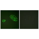 Immunofluorescence - Anti-HER3 Antibody (B0945) - Antibodies.com