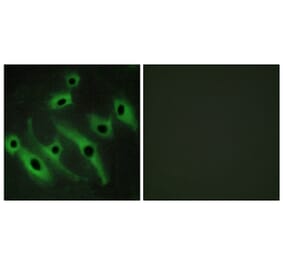 Immunofluorescence - Anti-HER2 Antibody (C12903) - Antibodies.com