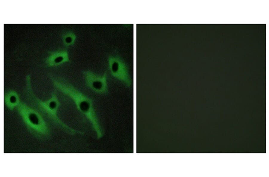 Immunofluorescence - Anti-HER2 Antibody (C12903) - Antibodies.com
