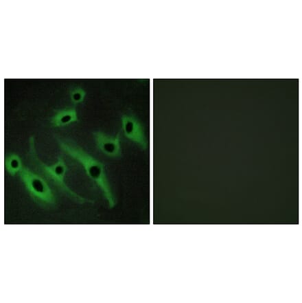 Immunofluorescence - Anti-HER2 Antibody (C12903) - Antibodies.com
