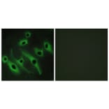 Immunofluorescence - Anti-HER2 Antibody (C12903) - Antibodies.com