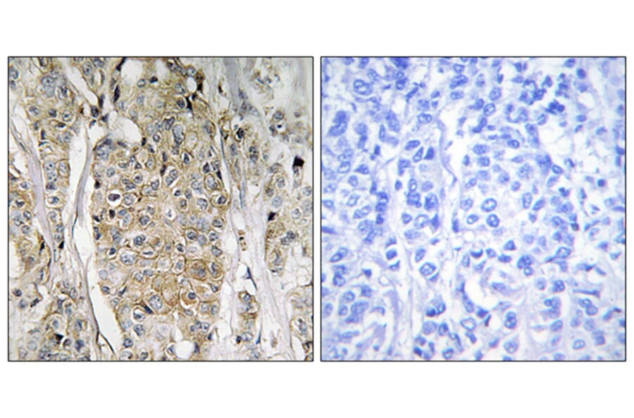 Immunohistochemistry - Anti-HER2 Antibody (C12903) - Antibodies.com