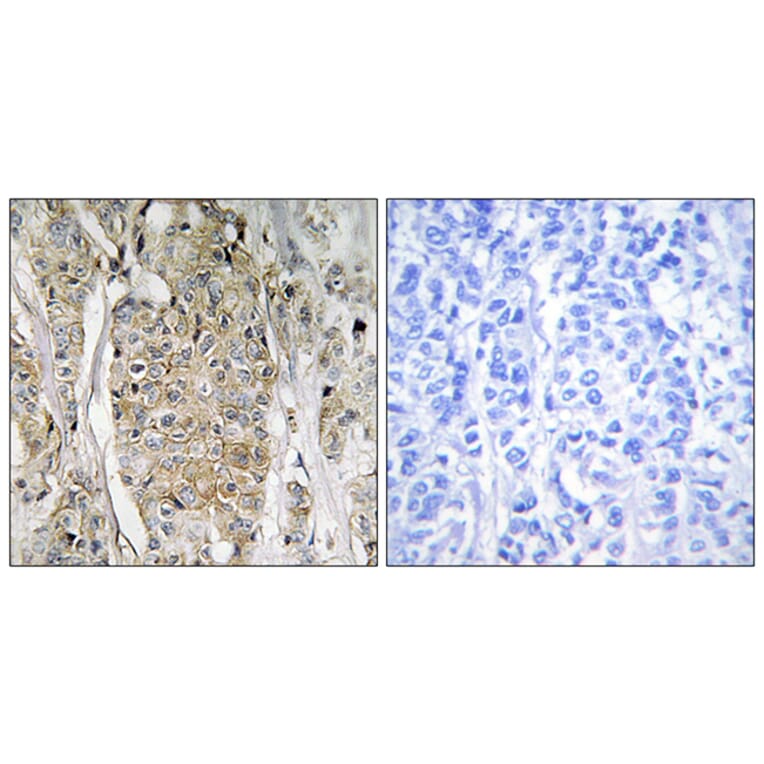 Immunohistochemistry - Anti-HER2 Antibody (C12903) - Antibodies.com