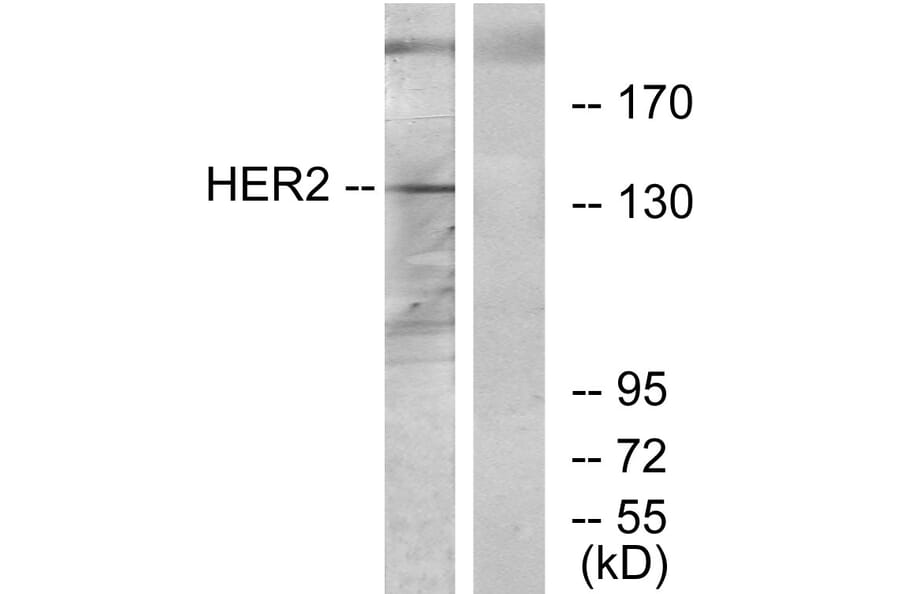 Western Blot - Anti-HER2 Antibody (C12903) - Antibodies.com